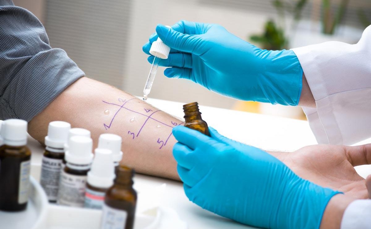 Allergy test
